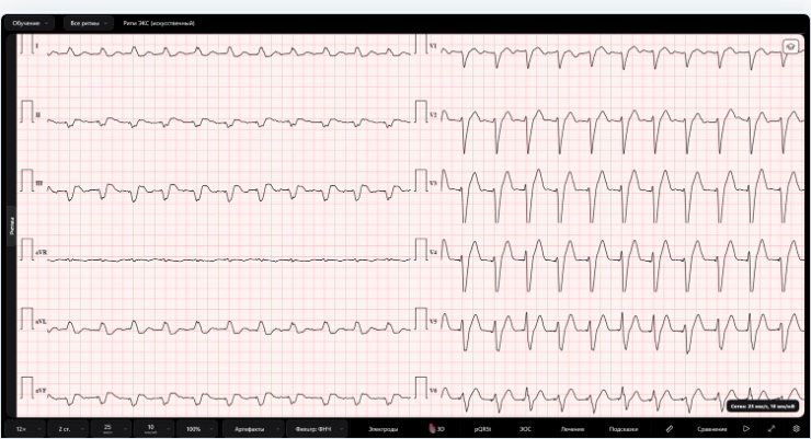 Монитор CardioSimulator